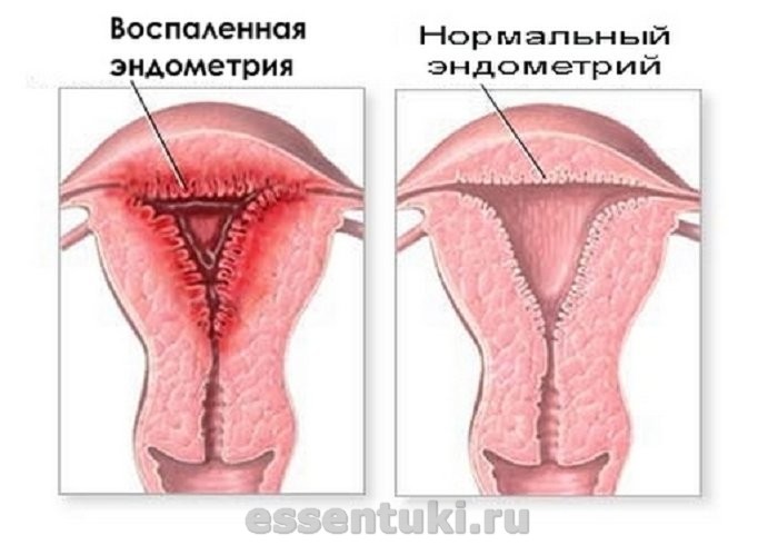Женские урологические заболевания